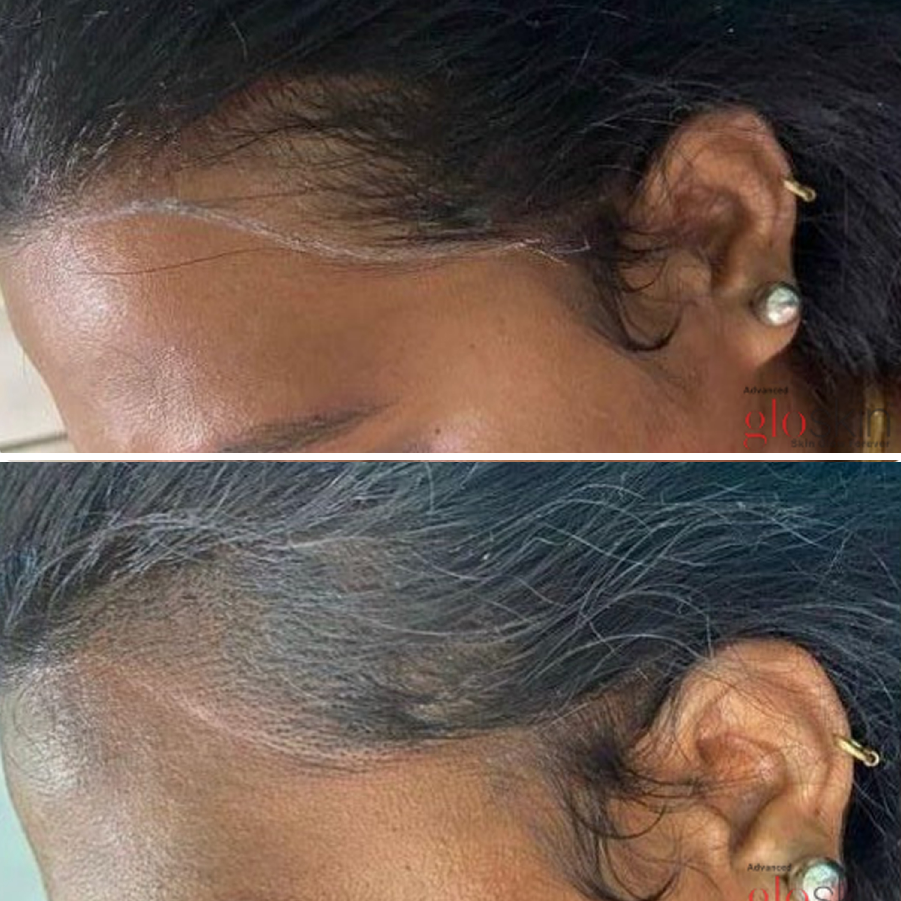 gro-hair-glo-skin-bannerghatta